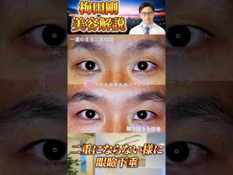 医学科 二重にしない二重切開 #うめだ美容外科クリニック #眼瞼下垂 #二重に見えない