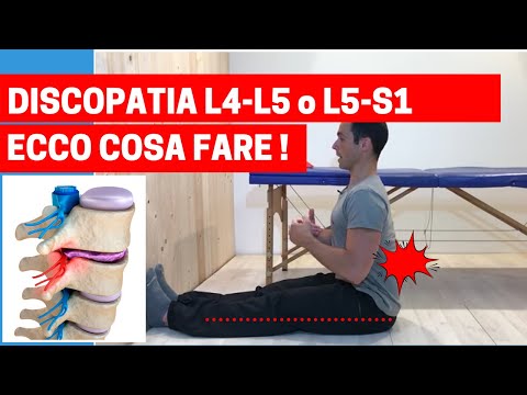 Piedino del rullo dopo lintervento chirurgico sul fianco buy congiunta Osteocondrosi cervicale insufficienza circolatoria