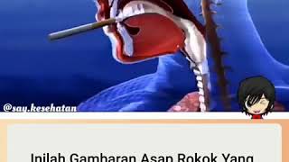 Download lagu GAMBAR ASAP ROKOK YANG MASUK KE DALAM TUBUH mp3