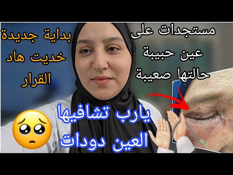 مستجدات على عين حبيبة حالتها صعيبة/بداية جديدة خديت هاد القرار/العين دودات 😢