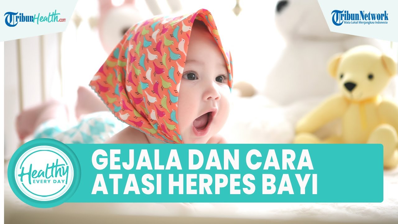 Gejala dan Cara Mengatasi Herpes pada Bayi yang Bisa Picu Gangguan Daya Tahan Tubuh - Tribun Video