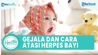 Gejala dan Cara Mengatasi Herpes pada Bayi yang Bisa Picu Gangguan Daya Tahan Tubuh