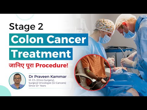 Stage 2 Colon Cancer Treatment: जानिए पूरा Procedure! | Early Detection and Treatment | Dr Praveen