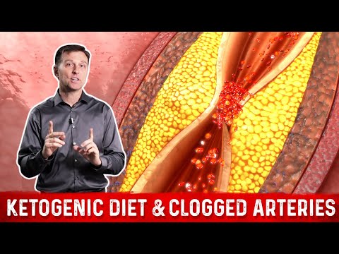 Dr Berg s Healthy Keto Diet Plan Intermittent Fasting and Fat Burning