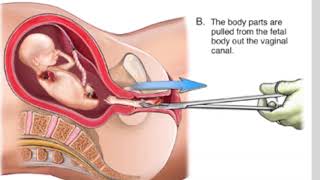 PFL-Who is the Primary Teacher of the Faith? Daily Scripture Reading and Reflection - August 24, 2024