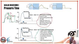 Lecture 8 Ventilator Waveforms