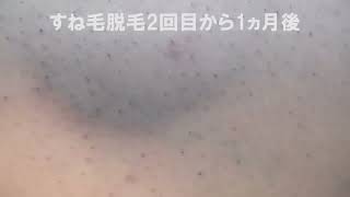 Bikini Wax in Japan