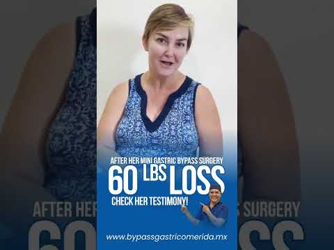 Logo of Mini Gastric Bypass, Mighty Results: 60lb Weight Loss Success in Mérida