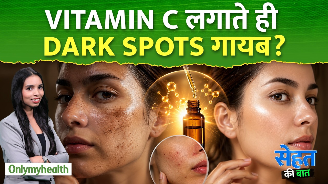 Vitamin C से Dark Spots सच में कम होते हैं या ये सिर्फ Trend है? Doctor Reveals | OnlyMyHealth