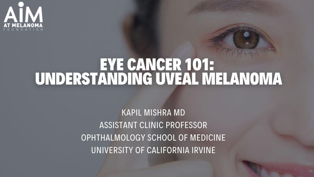 Eye Cancer 101: Understanding Uveal Melanoma