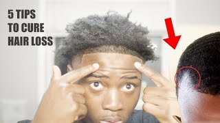 How To Naturally Cure Hair-loss , a Receding hairline , and Thinning in 30 days