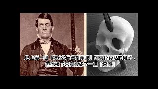 Re: [新聞] 8+9車禍後出血昏迷…14天甦醒秒變「乖寶