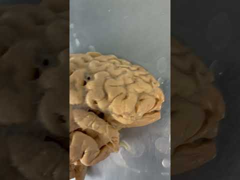 REAL Human Brain & Processing Vision!