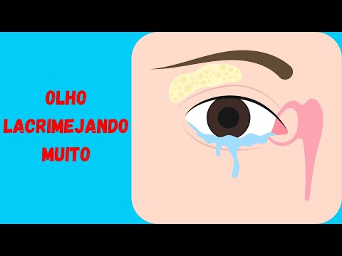 Olho Lacrimejando De Um Lado Só - Epífora - Olho Com Muita Lágrima E Escorrendo Sem Parrar