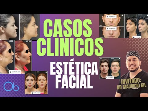 CASOS CLÍNICOS de Estética Facial