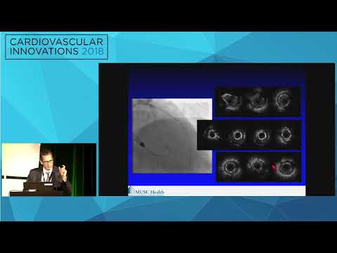 CVI2018 Session: Abrupt  vessel closure - Thomas Todoran, MD