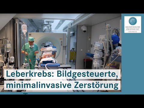 Krebs: Bildgesteuerte, minimalinvasive Zerstörung von Tumoren