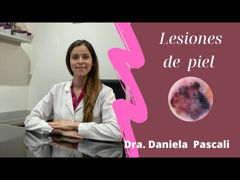 Lesiones de piel