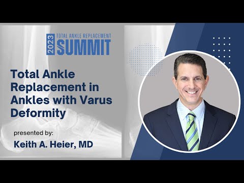 Total Ankle Replacement in Ankles with Varus Deformity - Keith A. Heier, MD