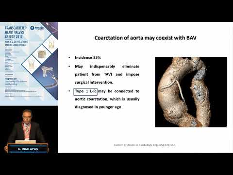 A. Chalapas  | CT Imaging of Bicuspid Aortic Valve Disease. Anatomic patterns favorable and     u...