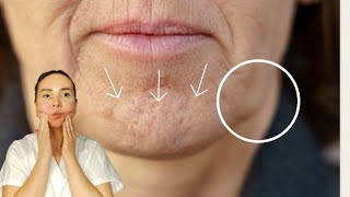 8 min massage for SAGGING JOWLS   and chin tension