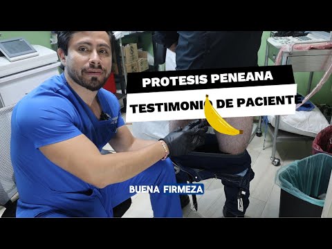 Historia de paciente operado en la clínica urológica