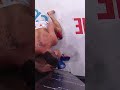 ʀᴏᴜɴᴅ 1️⃣ ᴠɪᴄᴛᴏʀʏ! ? Johnny Eblen vs Collin Huckbody #shorts #bellator299