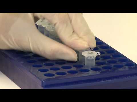 BioTech: Suche nach Antikörpern mit Hilfe von Automatisierung bei MorphoSys