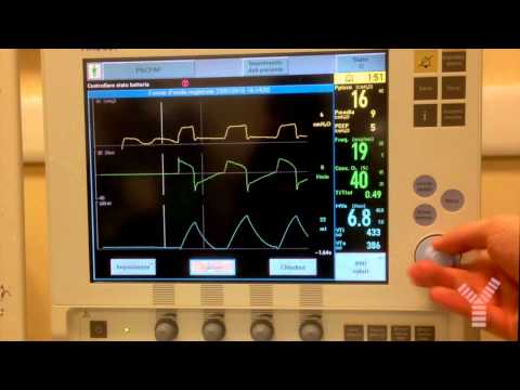 Maximum Inspiratory Pressure -MIP- (or Negative Inspiratory Force -NIF-) on Maquet Servo-i