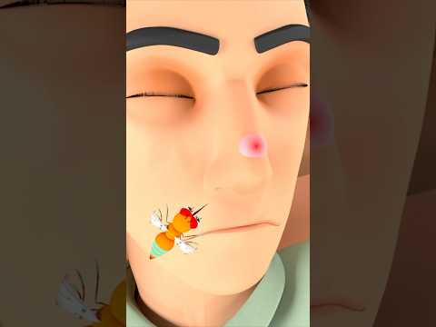 Scratch scratch itchy mosquito #kidssong #nurseryrhymes #kidslearning