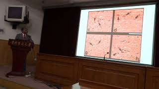 BDMV 8 Hari Sharma Invited Talk in Capital Medical University Hospital Beijing, China, Jun 06, 2013
