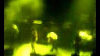 Hundred Reasons broken hands