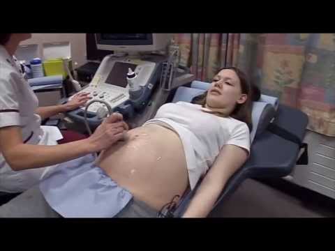 Teen Mum High - The Belly Edit