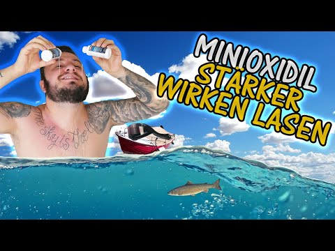 Minoxidil Bart STÄRKER wirken lassen | Minoxidil Selbstexperiment Woche 17 |  Kniescheibe