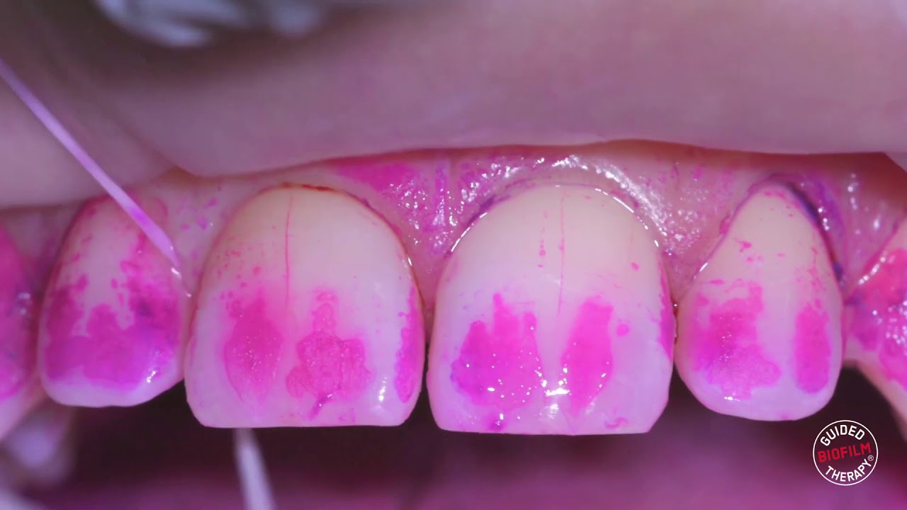 José Alan Villalobos Mendoza-5