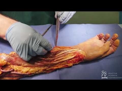 Anterior dissection of the right forearm