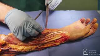 Anterior dissection of the right forearm