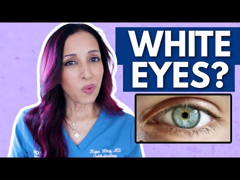 Why Your Eyes Aren't White | Eye Doctor Explains