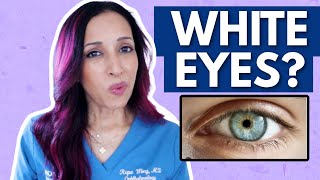 Why Your Eyes Aren