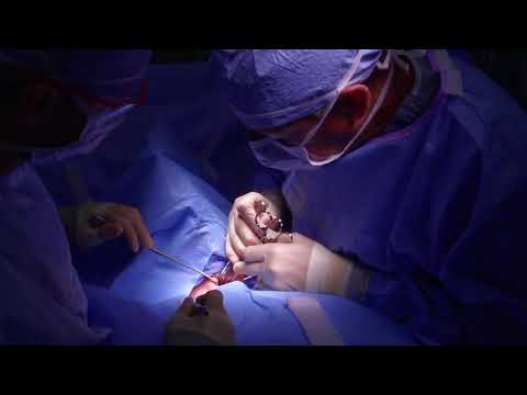 DANGERS OF HIGH CALCIUM - HYPERPARATHYROIDISM