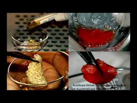 Tips & Tricks στην Εμφυτευματολογία και την χειρουργική του στόματος. (Dental TTT - Webinar No 41).