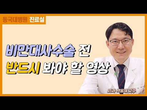 비만 대사 수술 전 반드시 봐야 할 영상