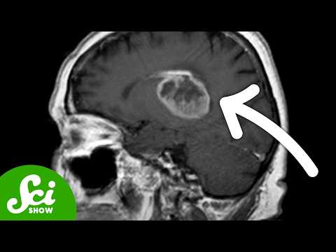 How to Turn Cancer Into Brain Cells