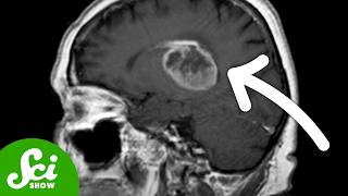 How to Turn Cancer Into Brain Cells