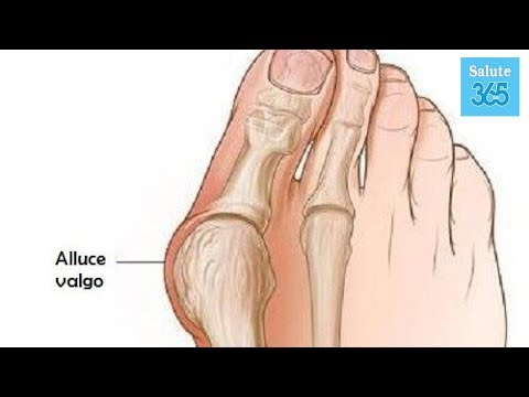 La mia schiena fa male dove i reni e il mal di stomaco Alflutop nellarticolazione del ginocchio