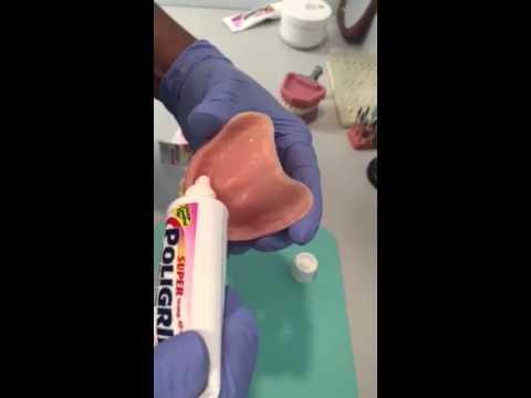 Applying denture adhesive paste