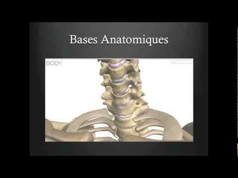 comment soulager une hernie discale cervicale