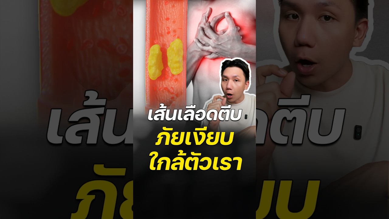 'เส้นเลือดตีบ' ภัยเงียบ ใกล้ตัวกว่าที่คิด