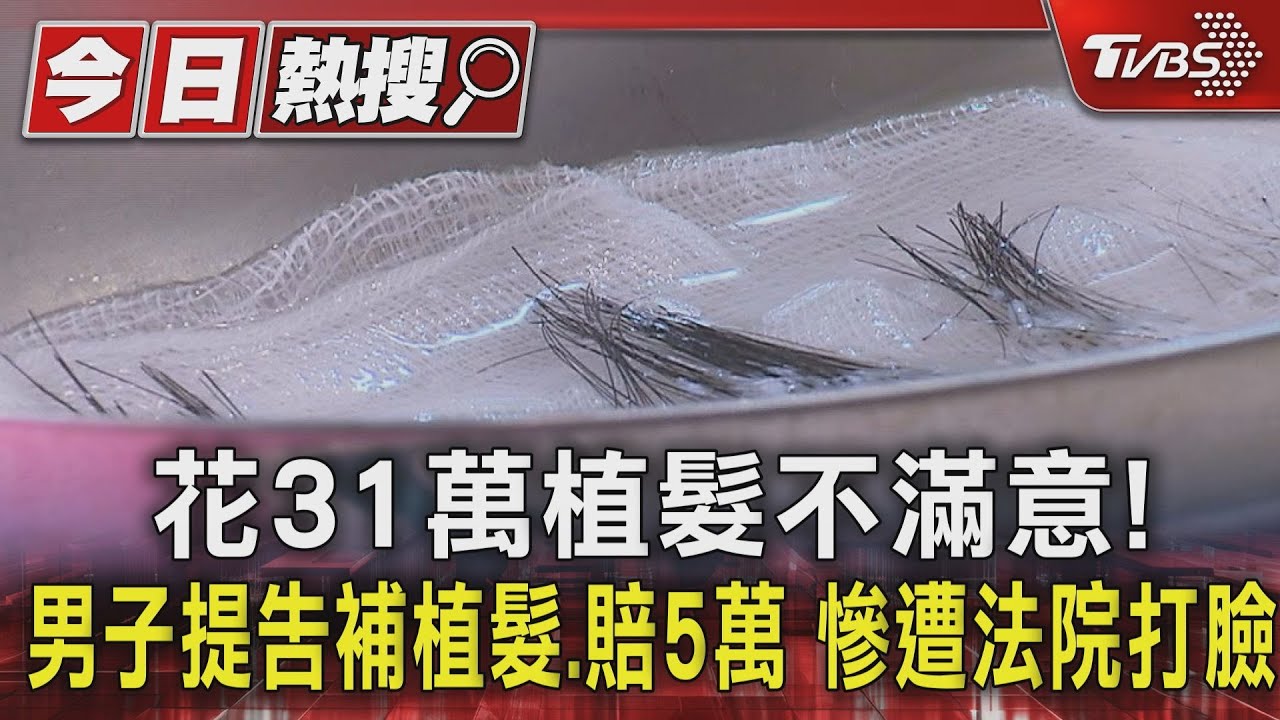 花31萬植髮不滿意！男子提告補植髮賠5萬　慘遭法院打臉