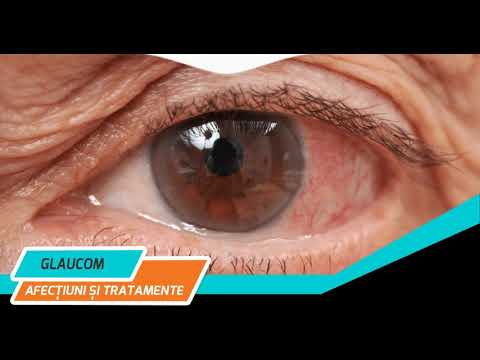 Îmbunătățirea trofismului tisular în oftalmologie